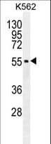MITF Antibody (aa1-28)