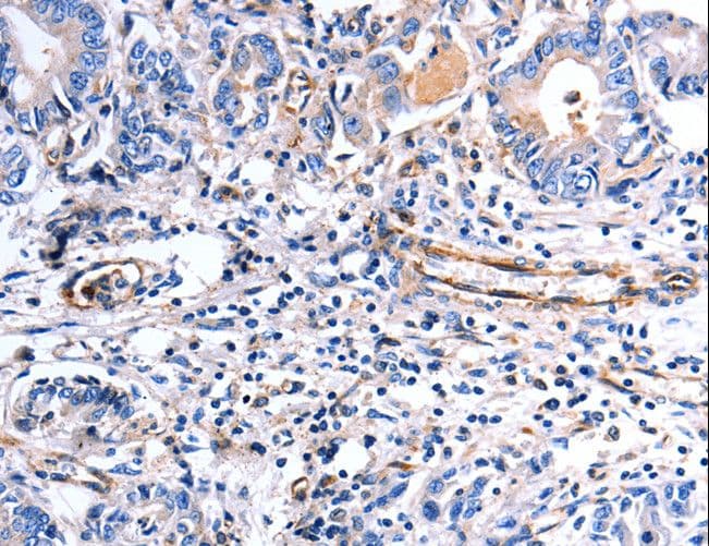 Polyclonal Rabbit anti-Human COX11 Antibody (IHC, WB)