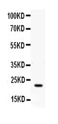 IFN Gamma / Interferon Gamma Antibody