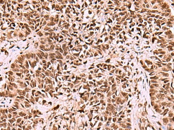 LDB1 / CLIM2 Antibody