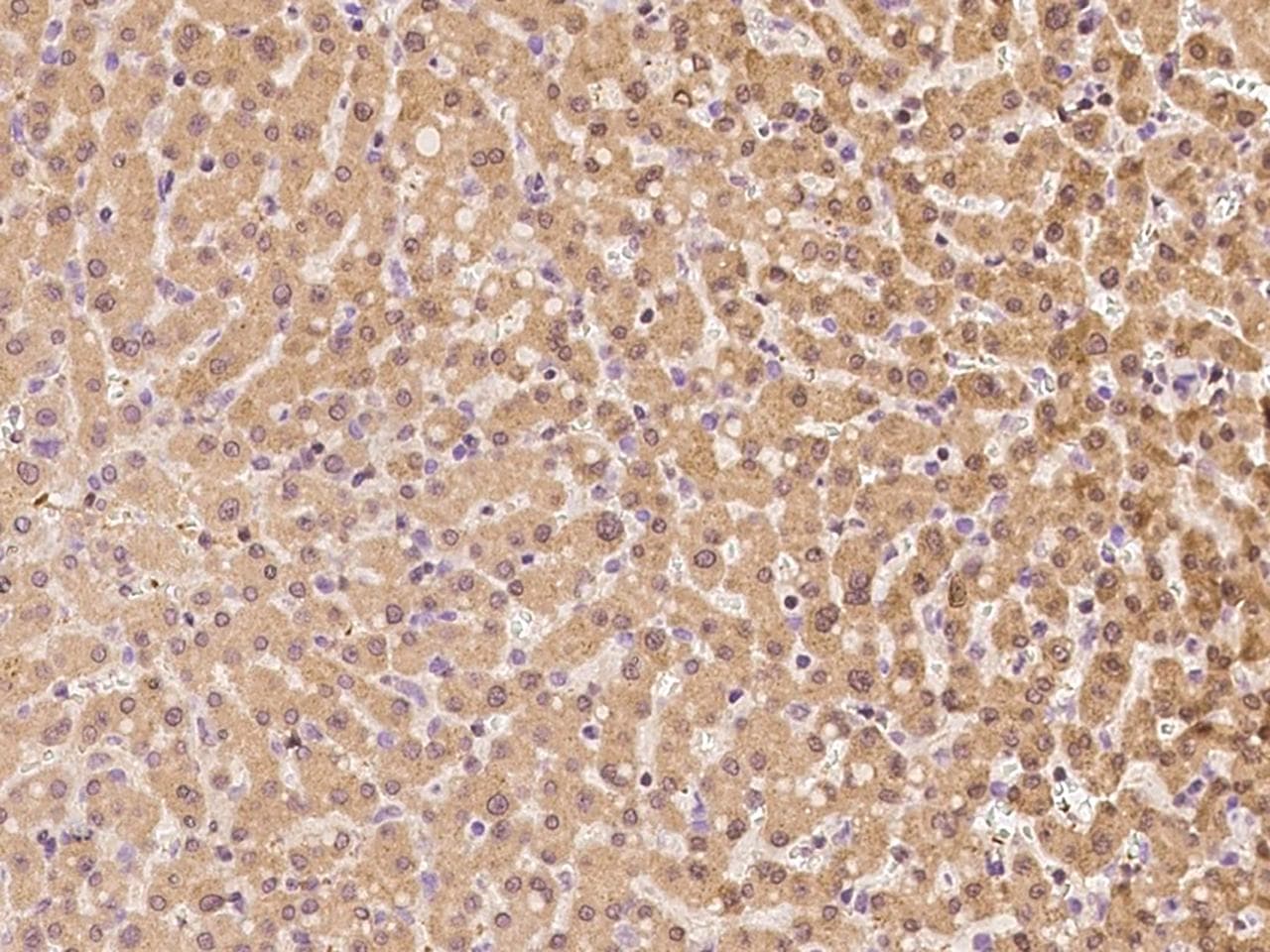 TTC14 Antibody