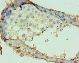 Polyclonal Rabbit anti-Human DPP2 / DPP7 Antibody (aa190-410, IHC, WB)