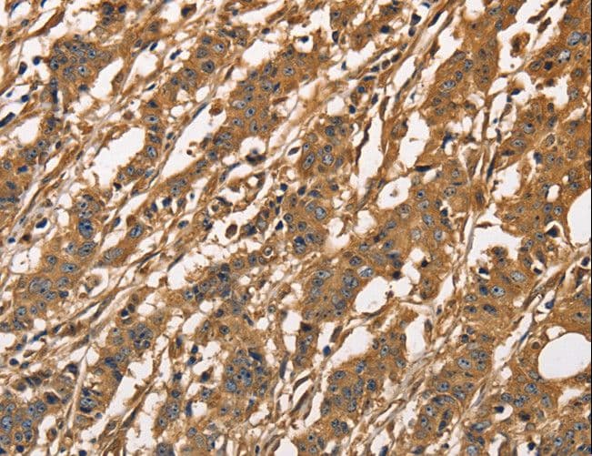 CAPZA3 Antibody