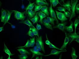 TUBB4 / Tubulin Beta 4 Antibody (clone 3C12, Carrier-free)