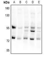 Polyclonal Rabbit anti-Human CEP95 / CCDC45 Antibody (WB)