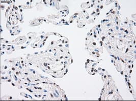 Monoclonal Mouse anti-Human MAP2K4 / MKK4 Antibody (clone OTI8A8, IHC, IF, WB)