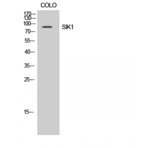 SIK1 / MSK Antibody (120-200 aa)