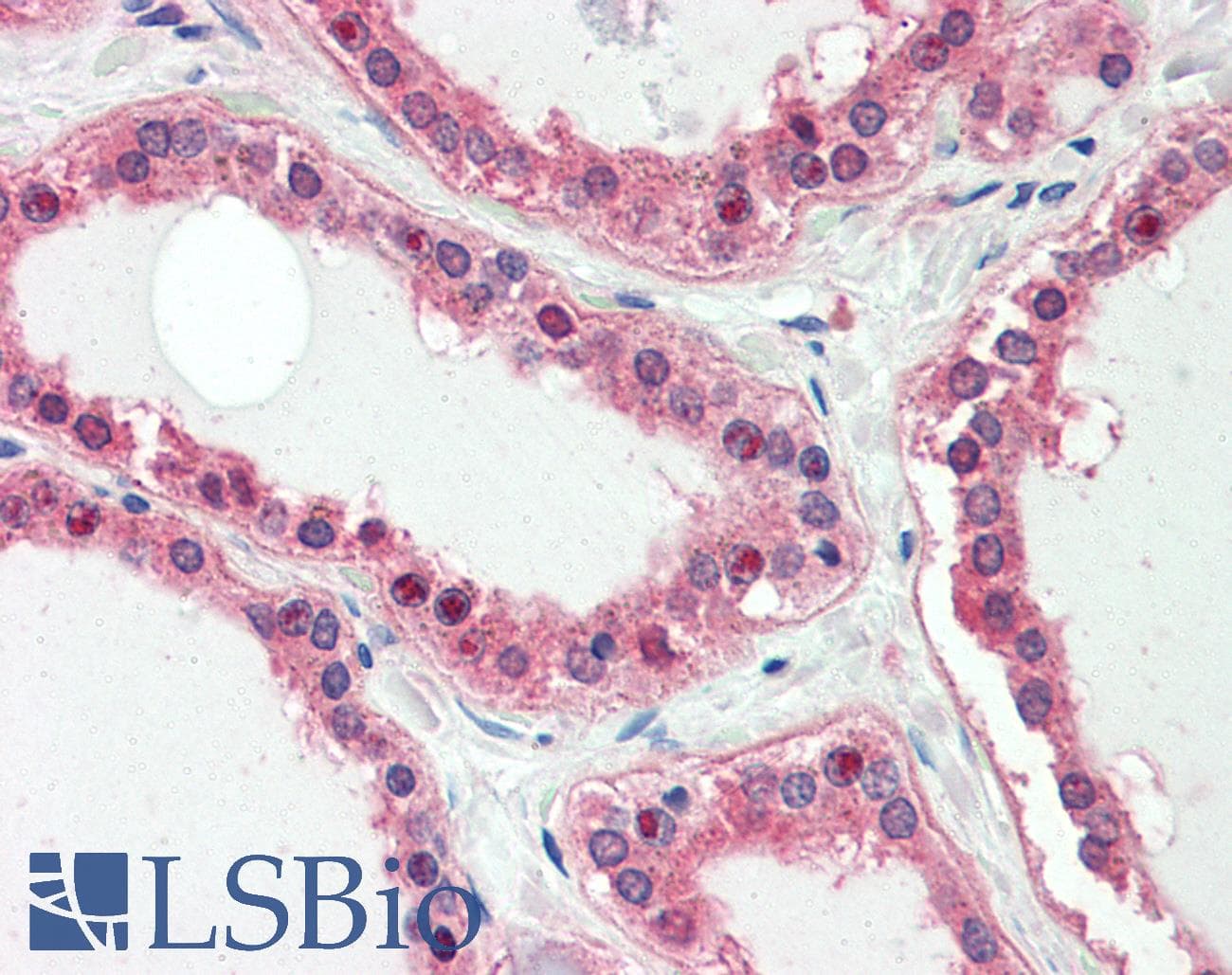 IHC-plus™ UXT Antibody (aa37-49)