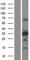 ZNRF1 Protein (Over-Expression Lysate Myc-DDK (Flag))
