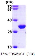 Human TIP30 / HTATIP2 Protein (Recombinant His)