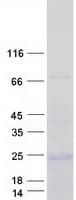 Human GCG / Glucagon Protein (Recombinant Myc-DDK (Flag))