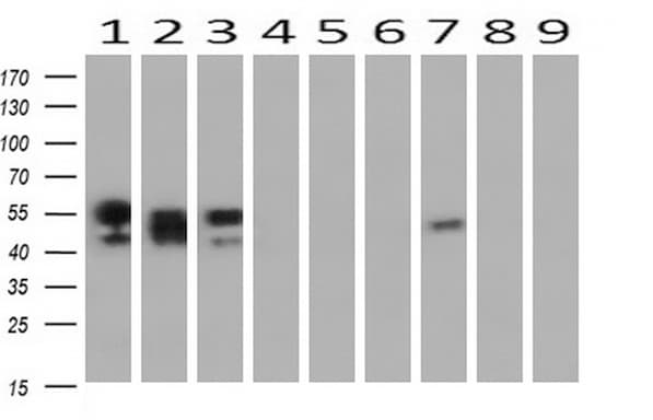 NONO / P54NRB Antibody (aa184-385, clone OTI5F1)