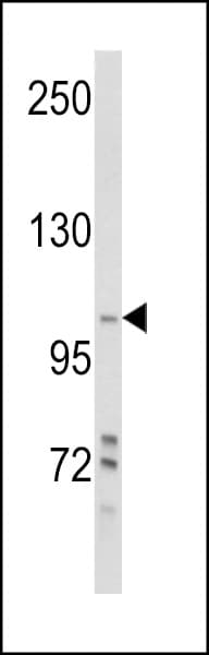 IHC-plus™ PIK3C3 / VPS34 Antibody (Ser425)