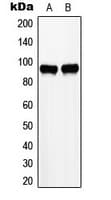 IHC-plus™ Polyclonal Rabbit anti-Human ZHX2 / RAF Antibody (C-Terminus, IHC, WB)