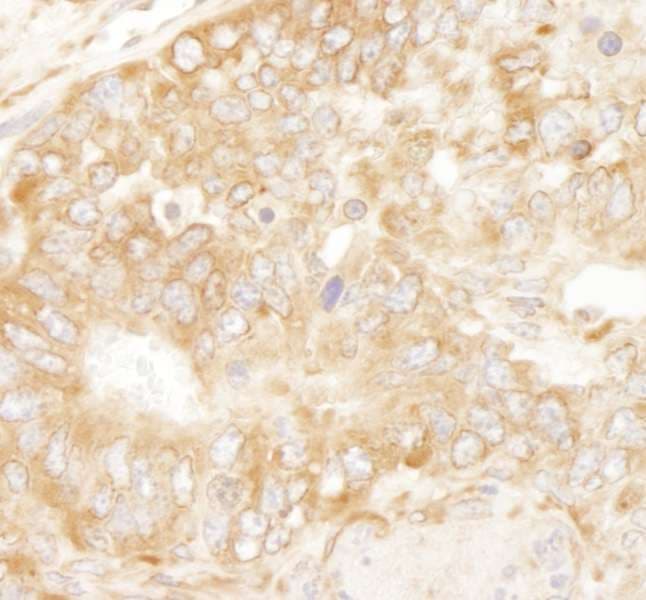 RPL7 / Ribosomal Protein L7 Antibody (aa200-C-term)