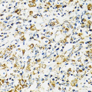 Polyclonal Rabbit anti-Human HSPA9 / Mortalin / GRP75 Antibody (IHC, IF, WB)