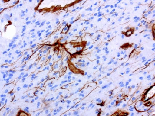 Monoclonal Mouse anti-Human Vimentin Antibody (clone UMAB159, Carrier-free, aa210-466, IHC, IF, WB)