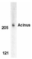 Polyclonal Rabbit anti-Human ACIN1 / Acinus Antibody (IF, WB)