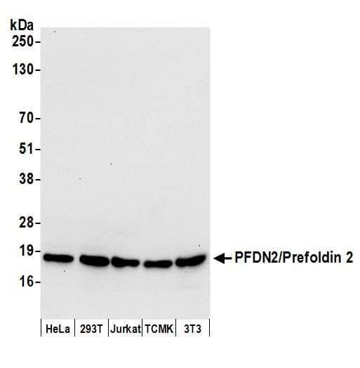 PFDN2 Antibody (aa104-154)