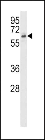 IHC-plus™ ACTRIIB / ACVR2B Antibody (aa1-30)