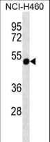 RSPH14 / RTDR1 Antibody (aa17-45)