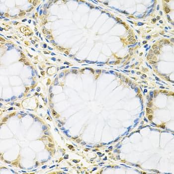 Polyclonal Rabbit anti-Human FMR1 / FMRP Antibody (IHC, IF, WB)