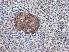USP10 Antibody (clone OTI1H9)