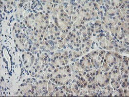 HRAS / H-Ras Antibody (clone OTI1C2)