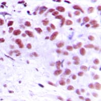 GAX / MEOX2 Antibody (Internal)
