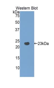 PANX1 / Pannexin 1 Antibody (aa77-260, Cy3)