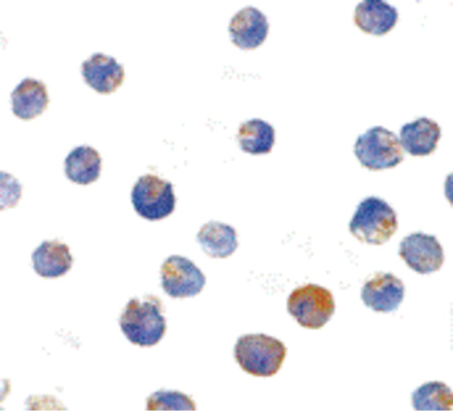 IHC-plus™ Polyclonal Rabbit anti-Human Tuberin / TSC2 Antibody (IHC, IF, WB)