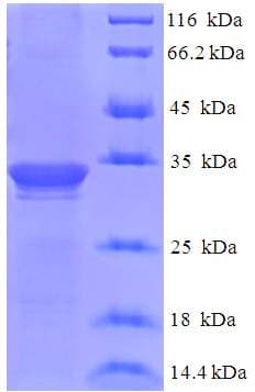 Human DBNDD2 Protein (Recombinant His-SUMO)