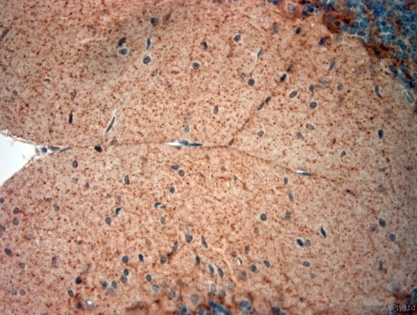 GAD 65+67 Antibody (aa530-600)