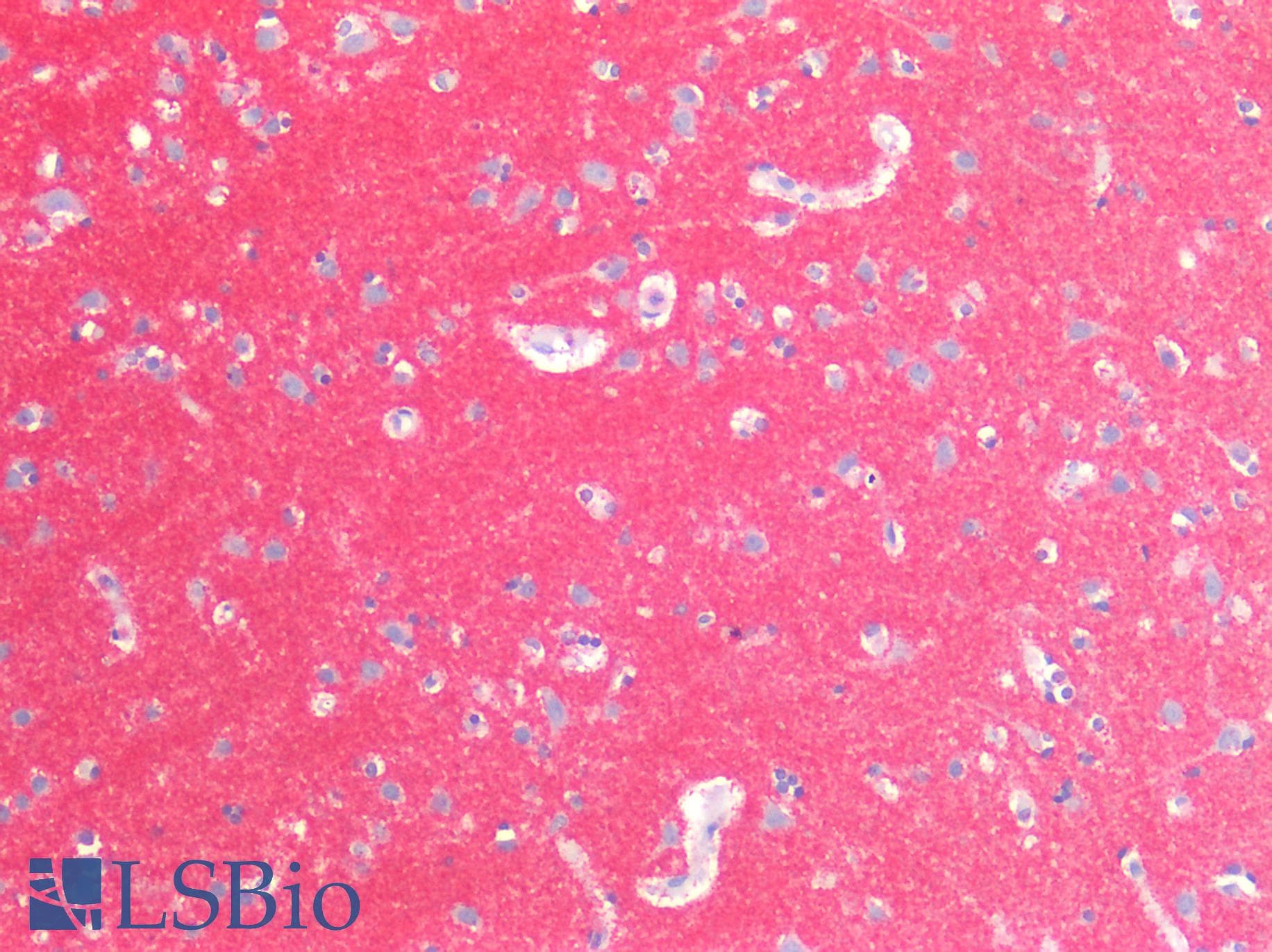 PathPlus™ CNTN1 / gp135 / Contactin 1 Antibody