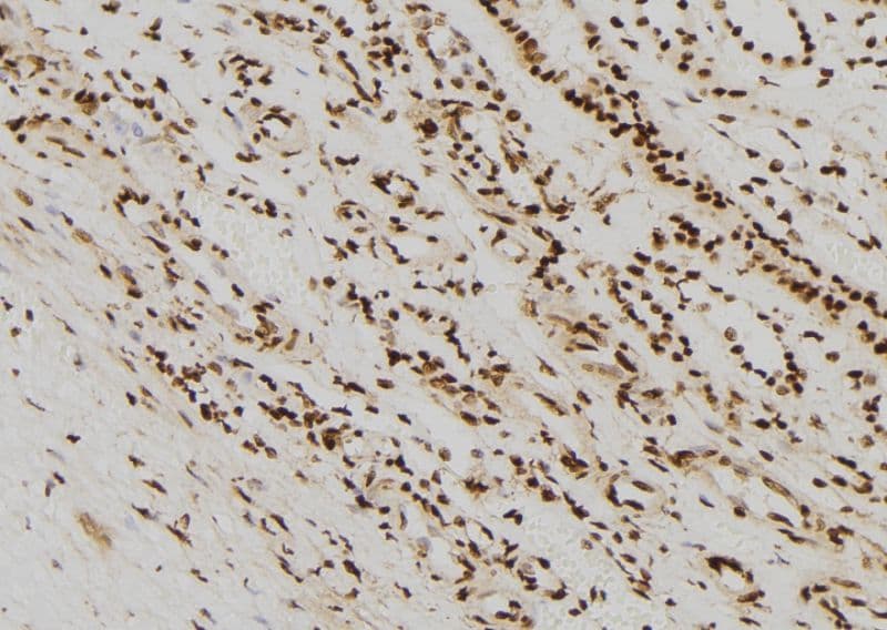 Polyclonal Rabbit anti-Human Vimentin Antibody (phospho-Ser56, IHC, IF, WB)