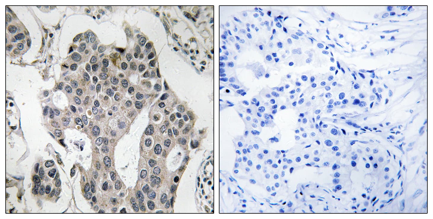 RAB3GAP2 / p150 Antibody (aa417-466)