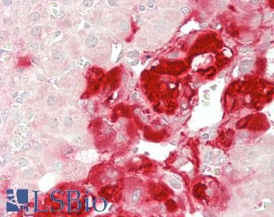 IHC-plus™ CLU / Clusterin Antibody (aa 23-224)