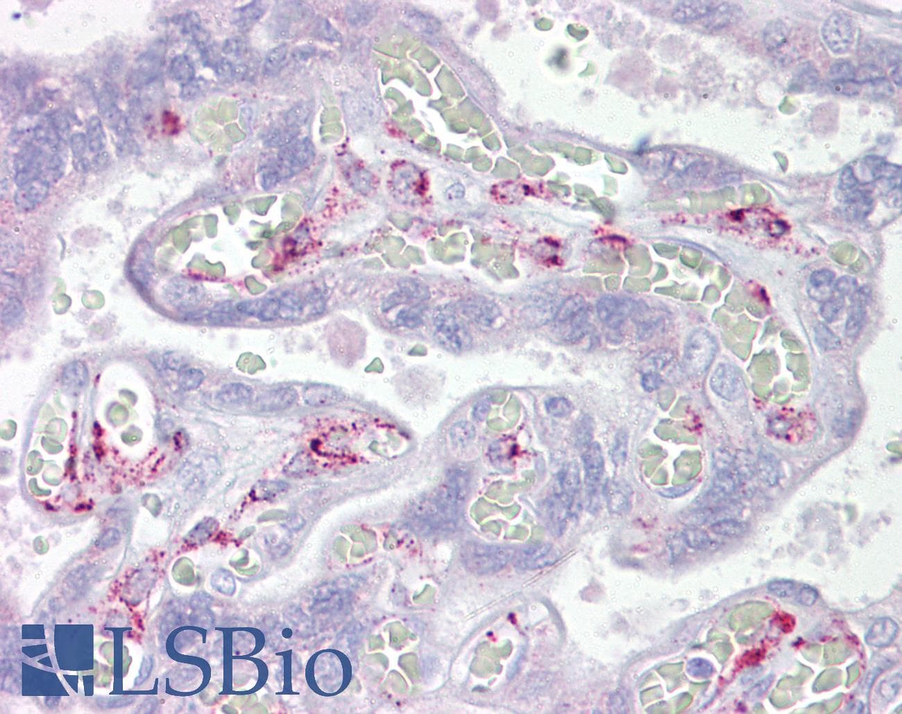 Polyclonal Rabbit anti-Human ING3 Antibody (aa36-85, IHC, WB)