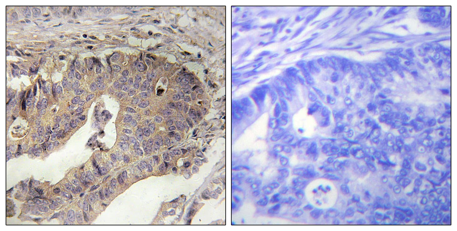 FBN1 / Fibrillin 1 Antibody (aa2811-2860)