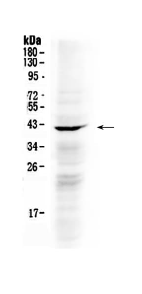 Polyclonal Rabbit anti-Human PAPD7 / TRF4-1 Antibody (IHC, WB)