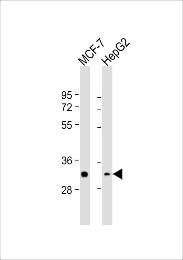 ZRANB2 / ZNF265 Antibody