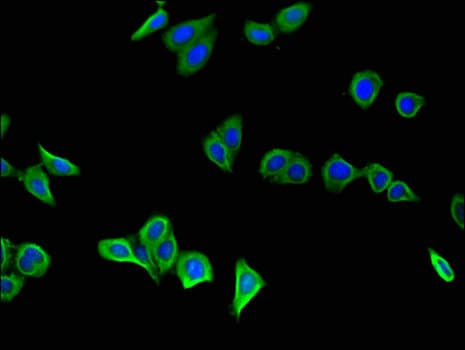 GSTA1 Antibody