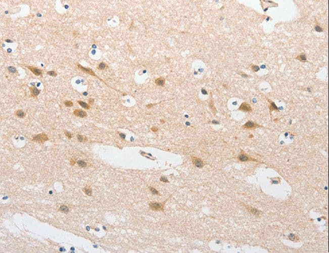 TLR5 Antibody