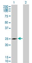 Monoclonal Mouse anti-Human NQO2 Antibody (clone 3E8-G2, WB)