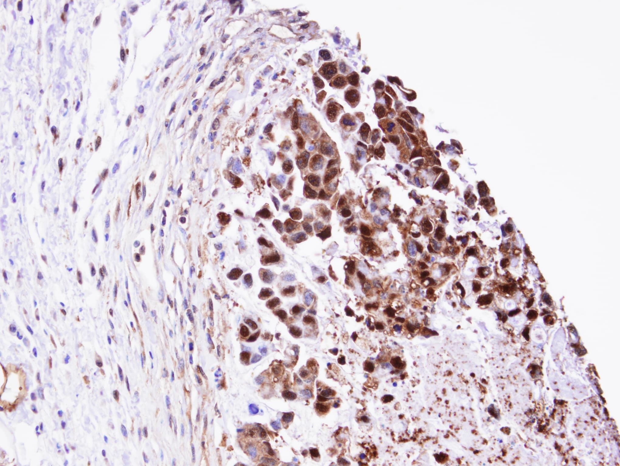 TPI1 / TPI Antibody (aa187-249)