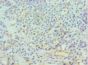 DFFA / ICAD / DFF45 Antibody (aa1-331)