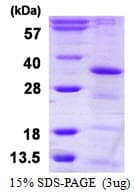 Human HAUS1 / CCDC5 Protein (Recombinant His)