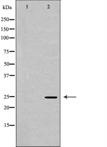 Polyclonal Rabbit anti-Human PSMA2 Antibody (IHC, WB)