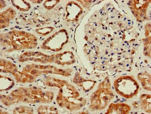 Polyclonal Rabbit anti-Human WISP3 Antibody (IHC, WB)