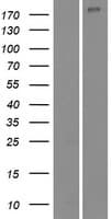 NUP210L Protein (Over-Expression Lysate Myc-DDK (Flag))